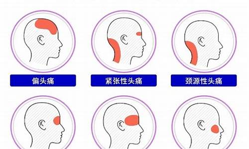 天气变化头疼_天气突变头疼耳痛